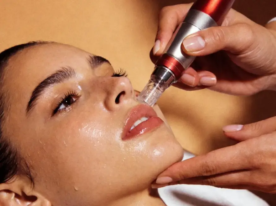 microneedling in Beverly Hills