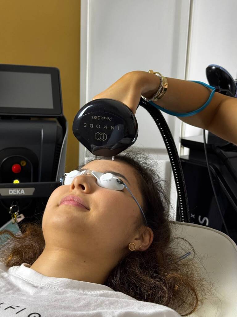 Discover Radiant Skin with IPL in Beverly Hills