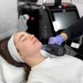 Morpheus8 in Beverly Hills – The Secret to Youthful, Radiant Skin