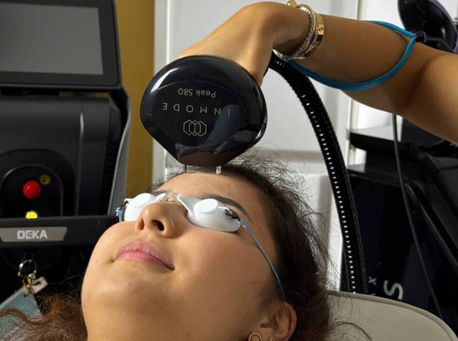 CO2 Laser Treatments