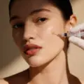 Subcision Acne Scar Treatment in Beverly Hills, CA