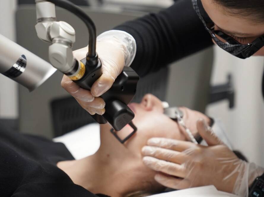 CoolPeel Laser in Beverly Hills