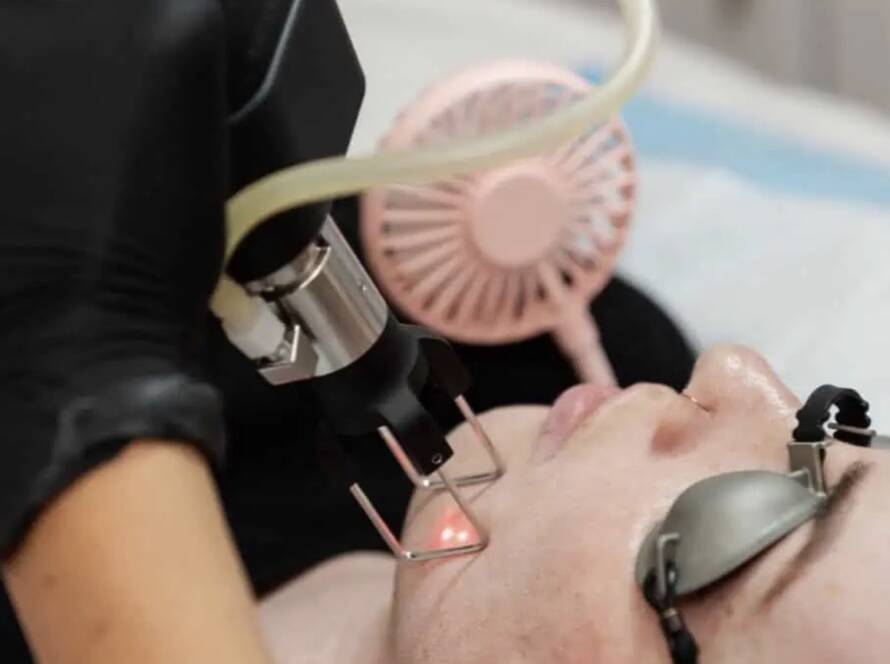 CoolPeel CO2 Laser Beverly Hills