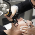 CoolPeel TetraPro CO₂ Laser in Beverly Hills