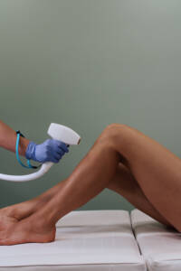 laser hair removal in Beverly Hills